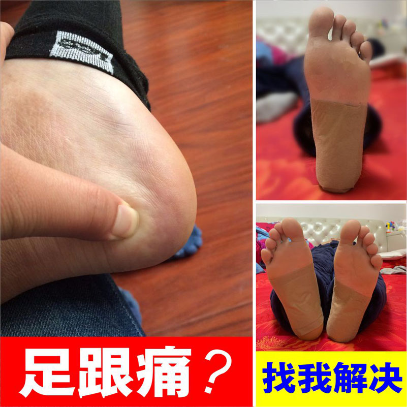 足跟痛贴膏脚跟疼跟腱炎贴脚后跟痛筋膜膏产后足跟痛脚跟痛安康膏