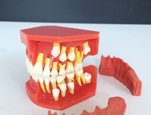 儿童乳牙替换牙齿模型 乳恒牙交替展示模型口腔沟通模型牙科模型