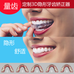星美定制3d隐形牙齿矫正器 透明牙套 龅牙牙缝牙齿不齐时代天使隐