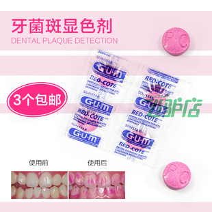 牙斑净牙齿美白白牙素速效去黄牙烟牙菌斑牙垢黑渍牙贴牙膏洗牙粉$