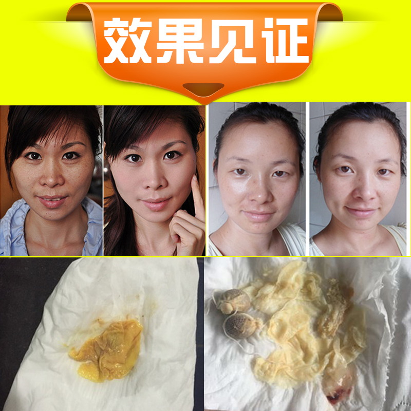 俏妃護宮福正品愛善天使御舒丹身體私處護理摩絲清宮丸婦科排毒丸