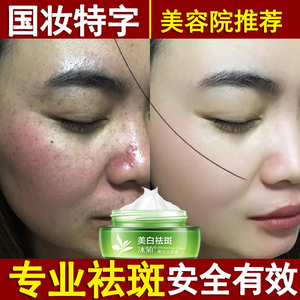 神仙膏贵妇膏正品祛斑美白图片