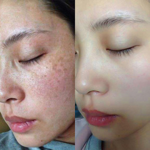 柏诗春天祛斑霜图片