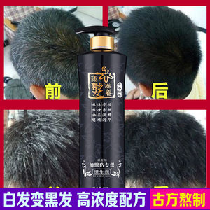 【黑发液图片】黑发液图片大全