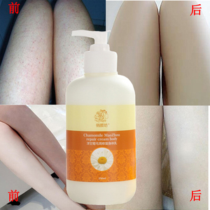普拉惠能改善鸡皮肤吗(普拉惠身体乳对鸡皮肤有用吗)